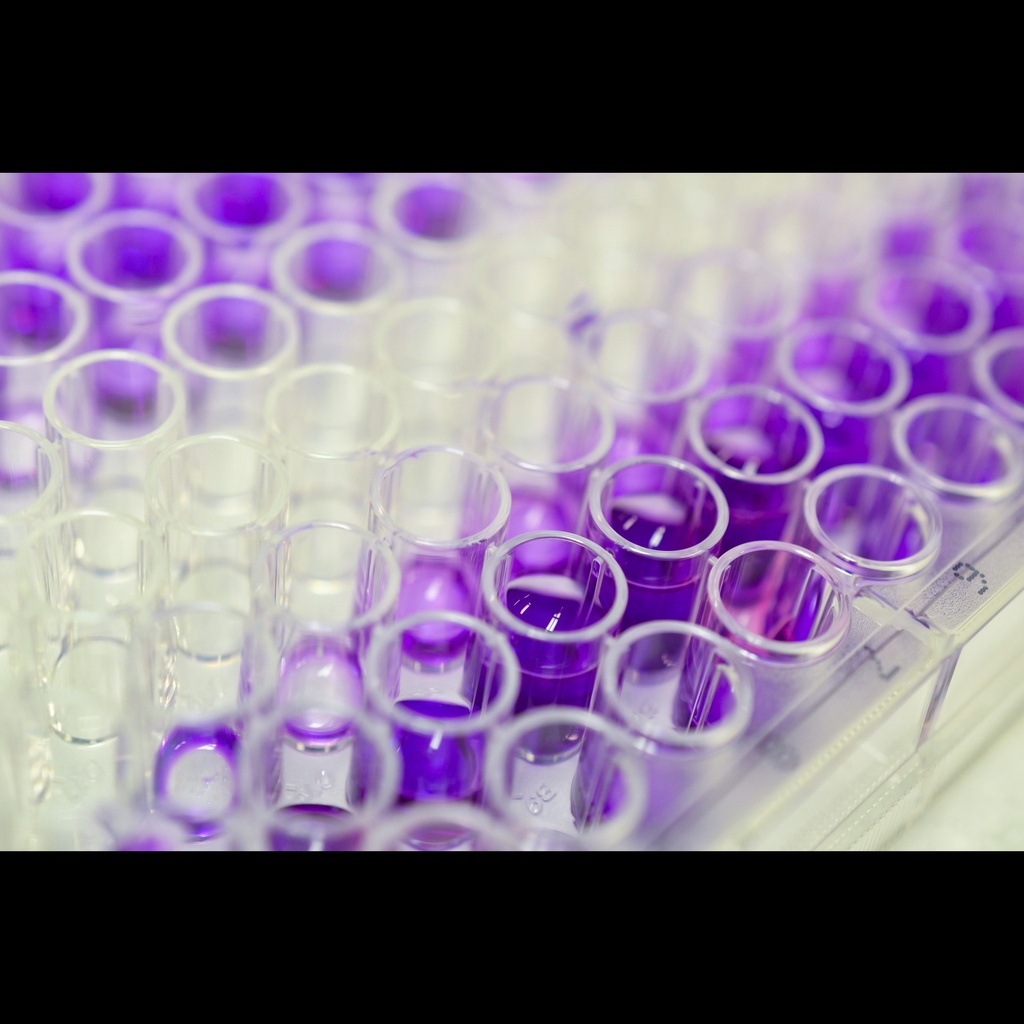 Borrelia burgdorferi IgG ELISA Kit size: 96 Tests