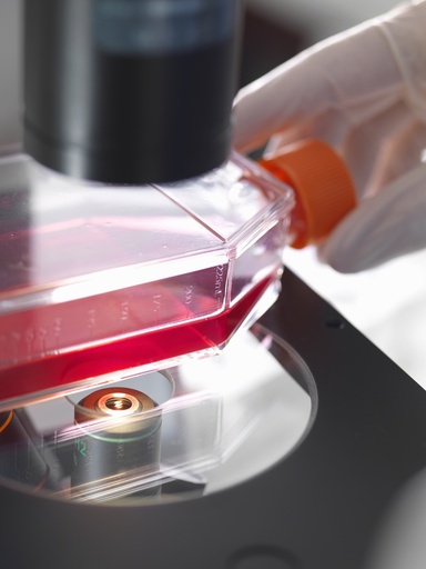 [ASTPLATE-SA2-123] Green Fluorescent Immortalized Human Umbilical Vein Endothelial Cells (HUVEC+GFP)